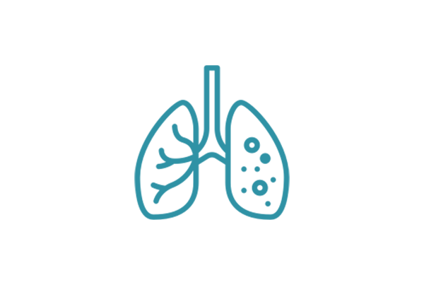 Tuberculosis (TB) Management