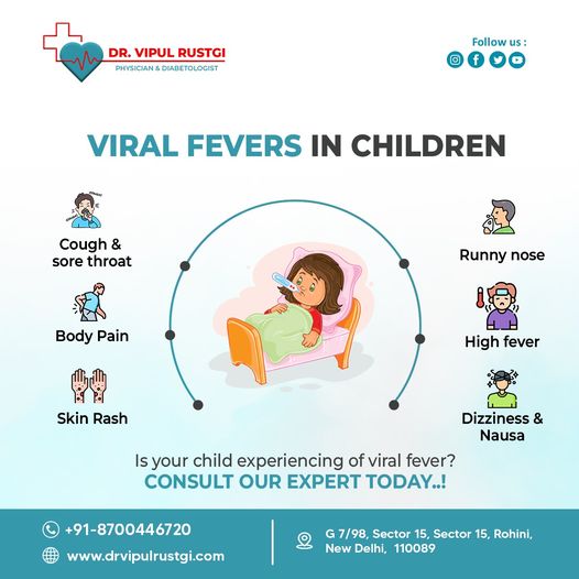 viral fever treatment