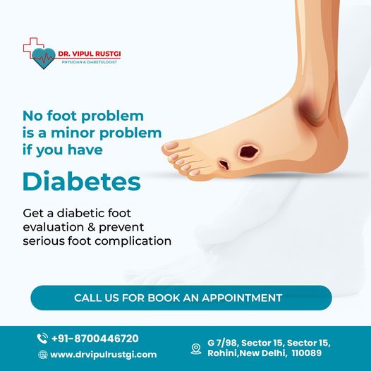 Diabetic Foot Treatment