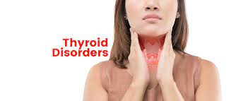 Thyroid Disordered Treatment