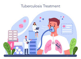 Tuberculosis Treatment